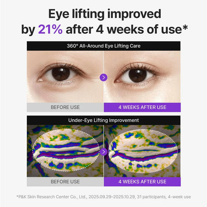 360º Shot PDRN lifting Eye cream 30ml